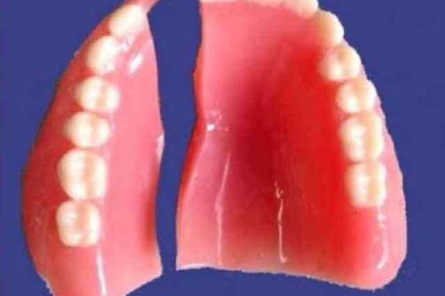دندانسازي ساخت دندان مصنوعي ژله اي