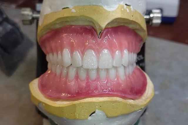 ساخت انواع دندان مصنوعي