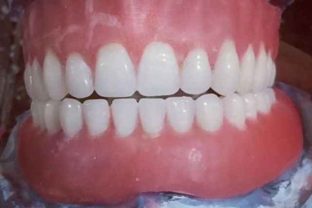 دندانسازي محلات ساخت دندان مصنوعي ژله اي