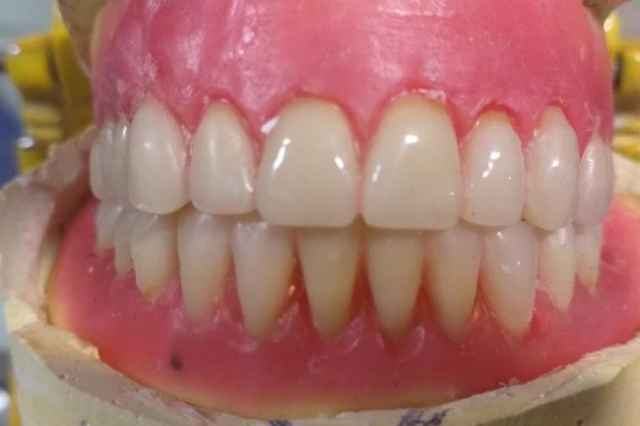 دندانسازي دندان ساز مصنوعي پروتز تعمير لق ترميم شكستگي