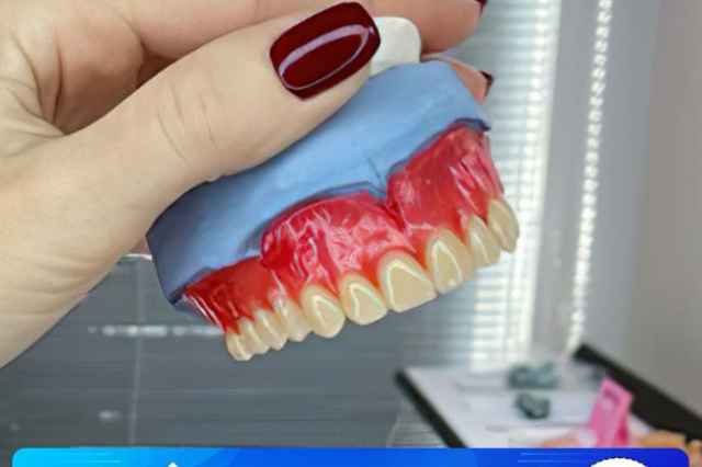 ساخت دندان مصنوعي